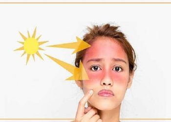 چند ماده غذایی موثر برای جلوگیری از آفتاب سوختگی