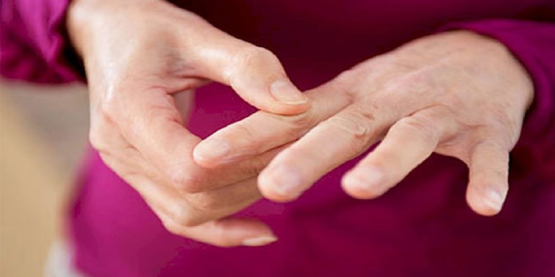 افزایش ریسک ابتلا به نقرس با سندرم متابولیک