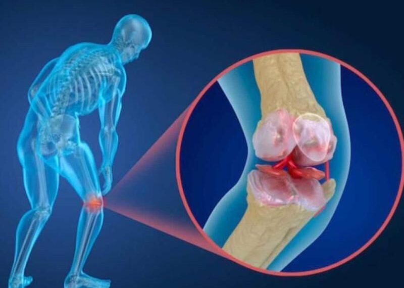 شکستگی ناشی از پوکی استخوان سبب تغییر کیفیت زندگی افراد می شود