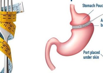 بهترین روش کاهش وزن چیست؟