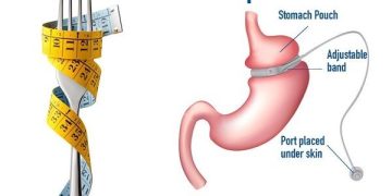 بهترین روش کاهش وزن چیست؟